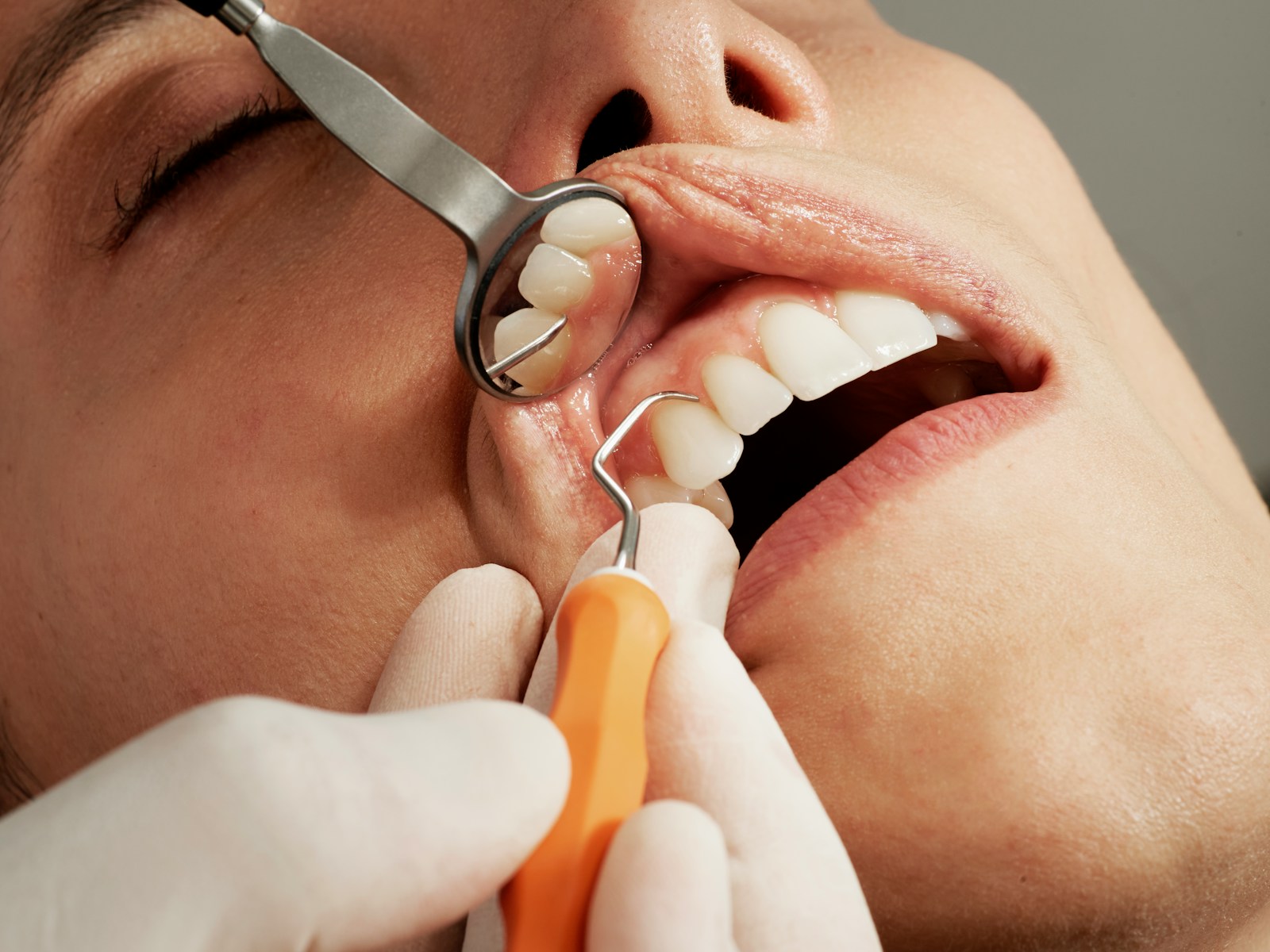 When to See a Dentist About Cavities